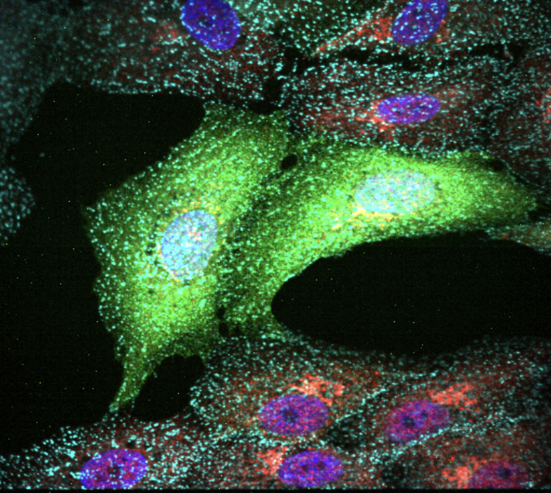 Micrograoh by PhD Candidate Natalie Uzynski